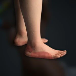 Leg Configurations