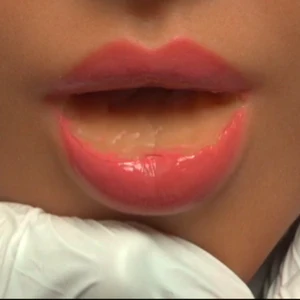 MOUTH TYPE