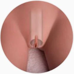 VAGINA TYPE:
